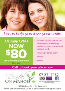 Limited Time Dental Promo | Dental On Mahoe Te Awamutu